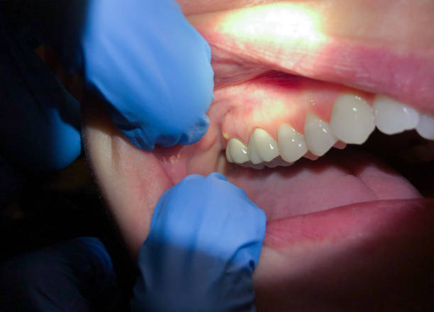 Best Mobile Emergency Dentist in St Augustine Shores, FL